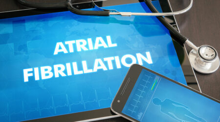 Atrial fibrillation &#8211; What it is, how its caused, and ways to manage it