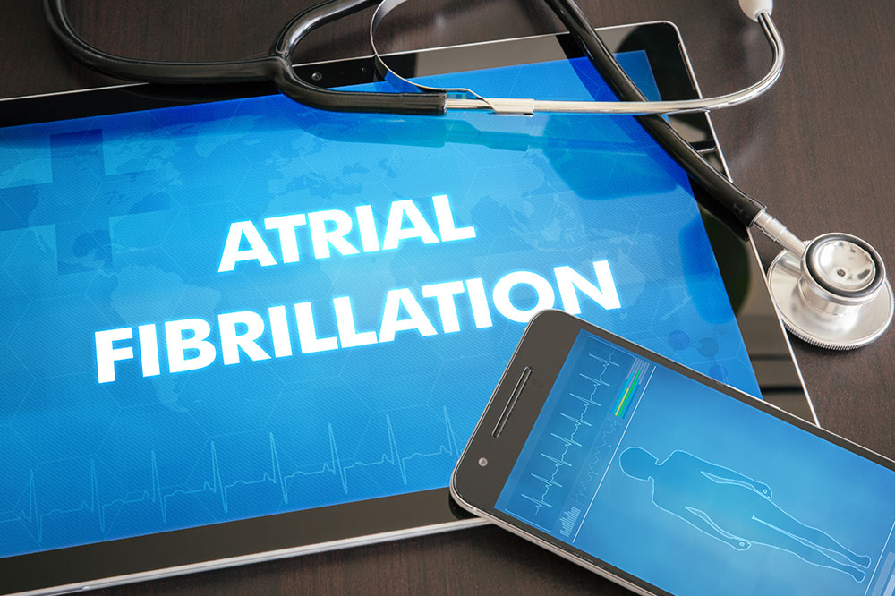 Atrial fibrillation &#8211; What it is, how its caused, and ways to manage it