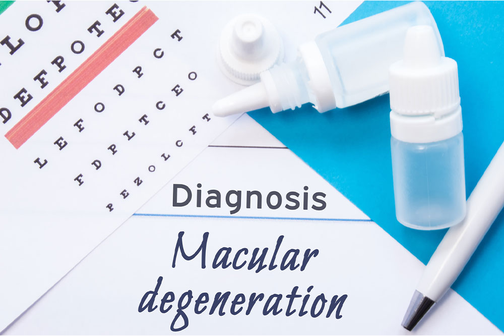 A brief overview on macular degeneration