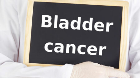 Bladder cancer &#8211; A comprehensive guide