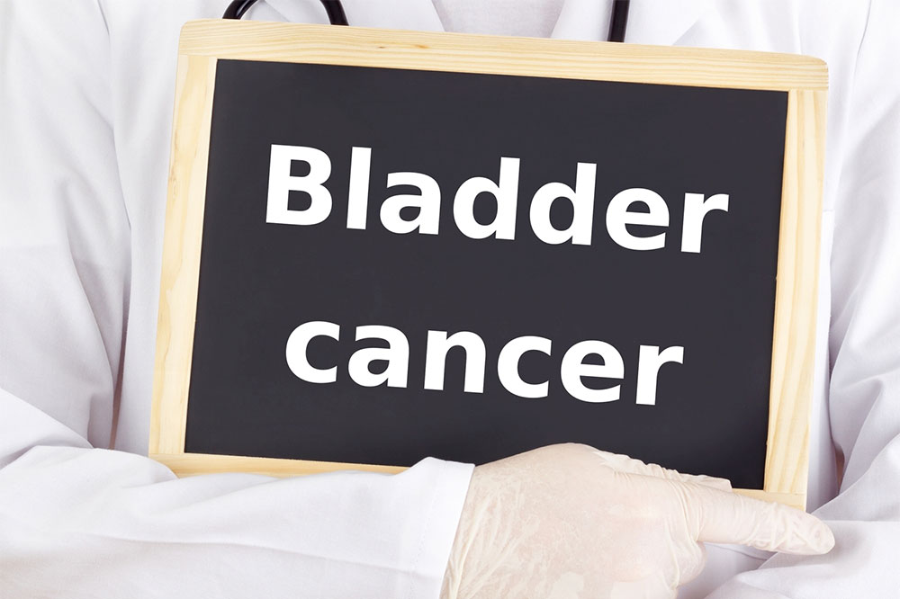 Bladder cancer &#8211; A comprehensive guide