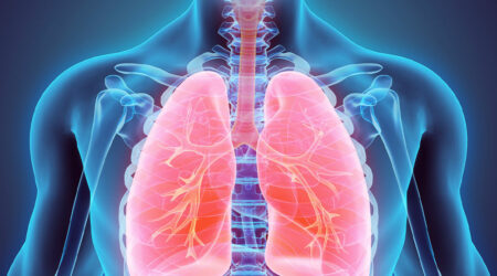 Lung cancer &#8211; Everything you need to know