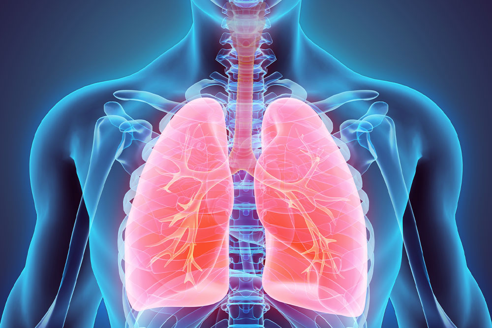 Lung cancer &#8211; Everything you need to know