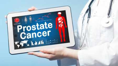 Prostate cancer &#8211; Causes, symptoms, diagnosis, and treatment