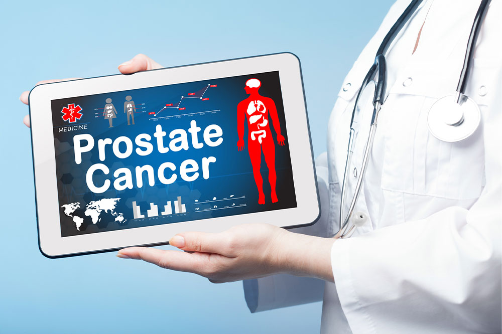 Prostate cancer &#8211; Causes, symptoms, diagnosis, and treatment