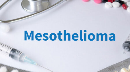 Mesothelioma cancer &#8211; Causes, symptoms, diagnosis, and management