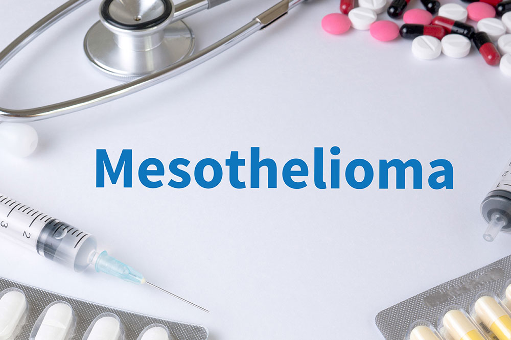 Mesothelioma cancer &#8211; Causes, symptoms, diagnosis, and management