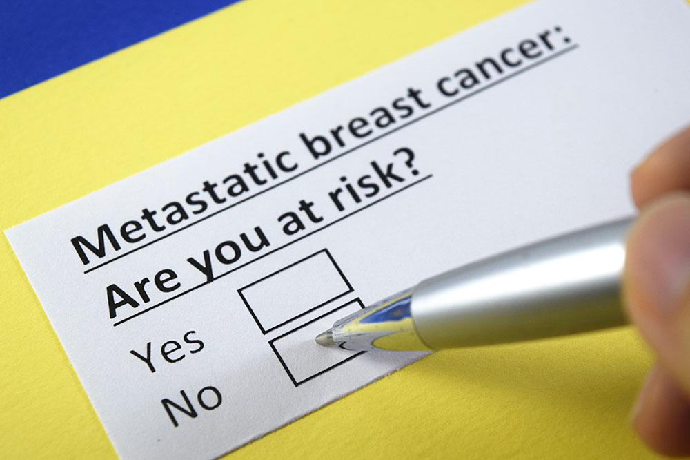 Metastatic breast cancer &#8211; Causes, symptoms, and management