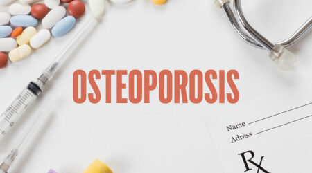 Osteoporosis &#8211; Causes, symptoms, diagnosis, and management