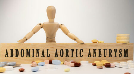 Abdominal Aortic Aneurysm &#8211; Causes, signs, diagnosis, and more