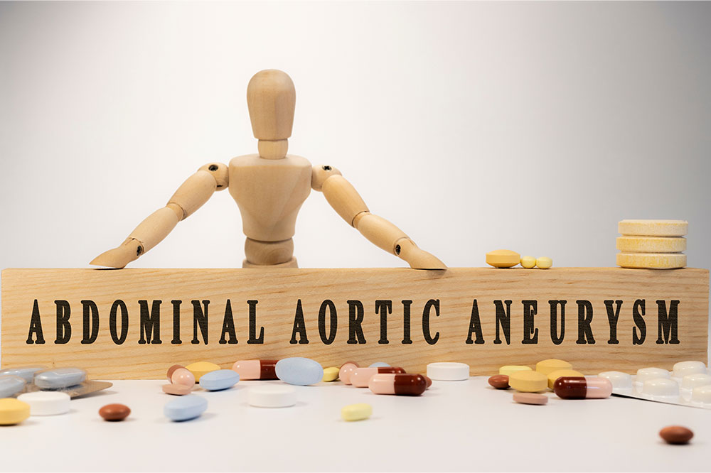 Abdominal Aortic Aneurysm &#8211; Causes, signs, diagnosis, and more