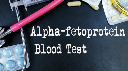 Everything to know about the alpha-fetoprotein test