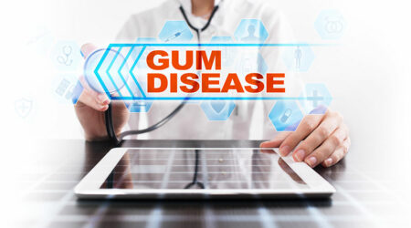 Gum disease &#8211; Causes, symptoms, diagnosis, and management