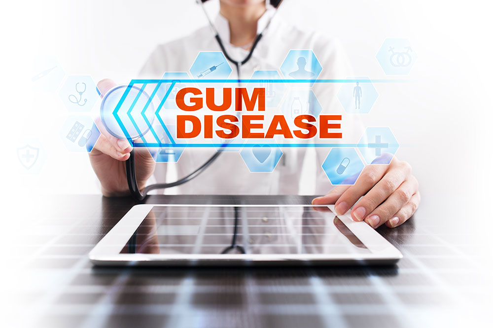 Gum disease &#8211; Causes, symptoms, diagnosis, and management