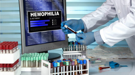 Hemophilia &#8211; Types, symptoms, and management