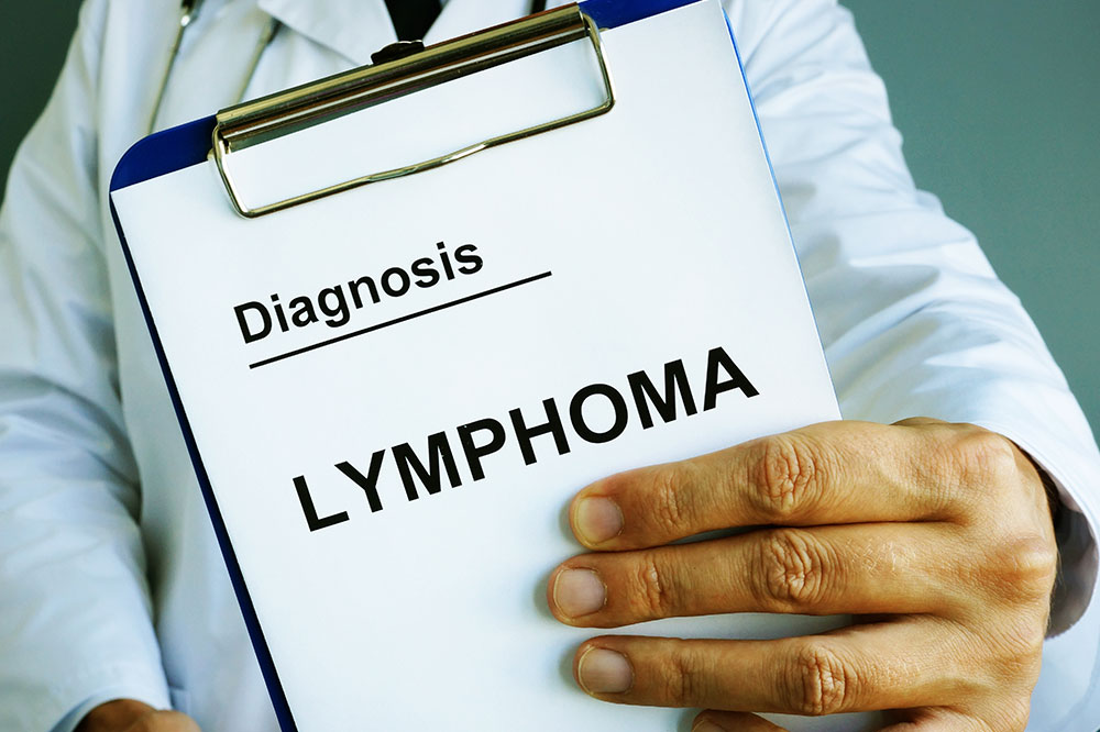 Lymphoma &#8211; Causes, risk factors, symptoms, and more