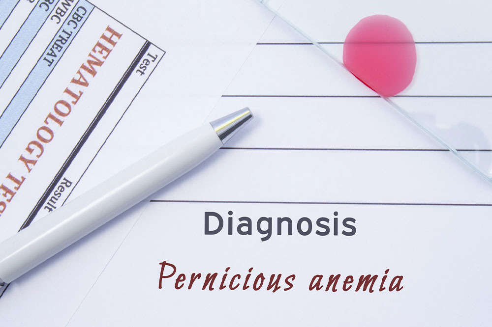 Pernicious anemia &#8211; Causes, symptoms, and management