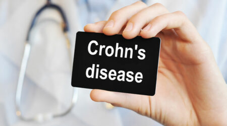 Crohn&#8217;s disease &#8211; Causes, symptoms, and management