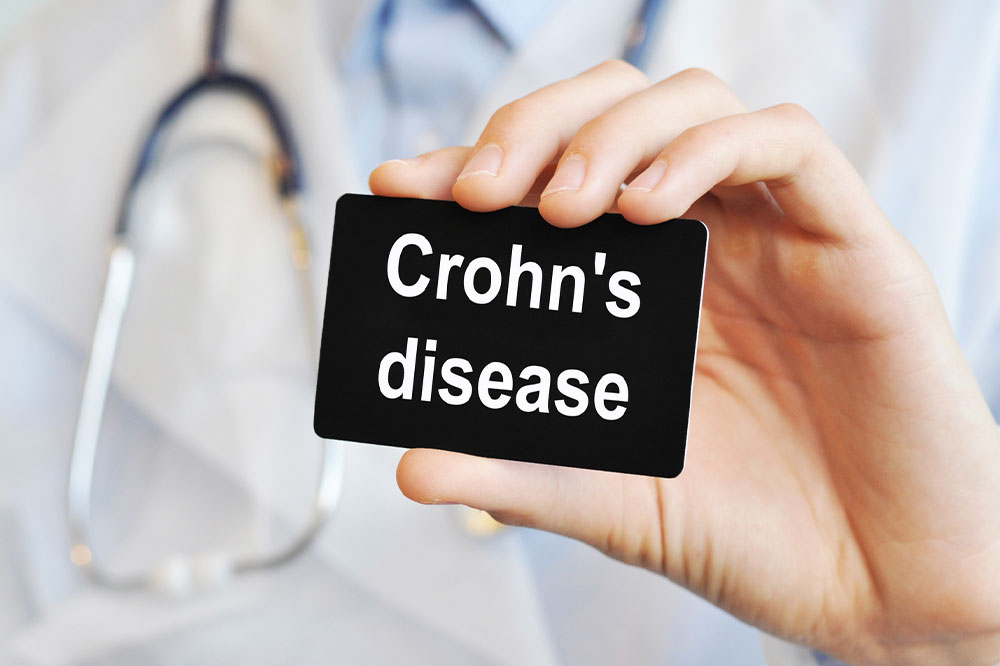 Crohn&#8217;s disease &#8211; Causes, symptoms, and management