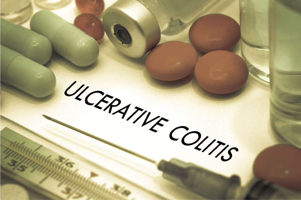 Ulcerative colitis &#8211; Symptoms, causes, and remedies