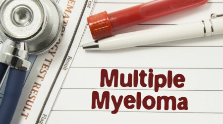 Multiple myeloma – Causes, symptoms, and management