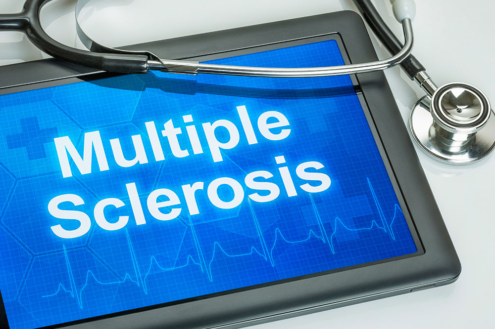 Multiple sclerosis &#8211; Causes, signs, and management options