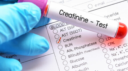 7 natural ways to lower creatinine levels