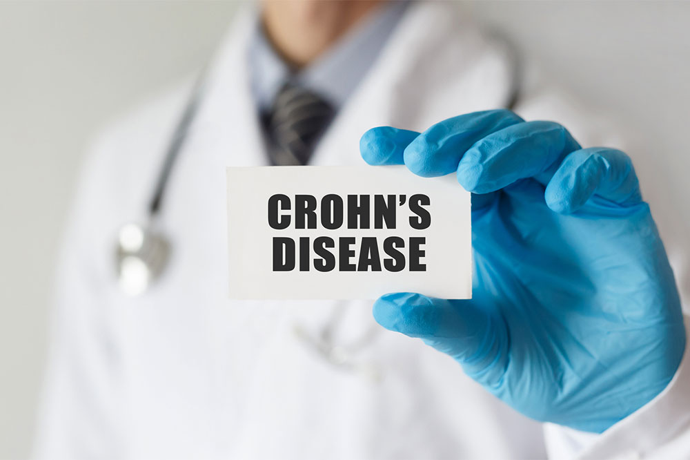 Crohn’s disease – warning signs, causes, diagnosis, and management