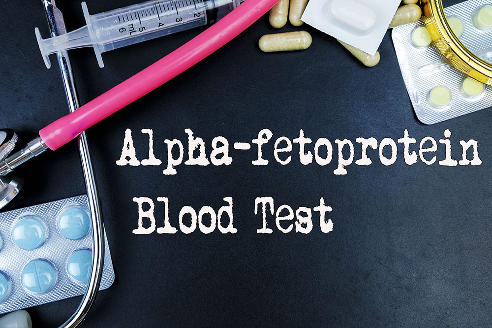 Everything to know about the alpha-fetoprotein test